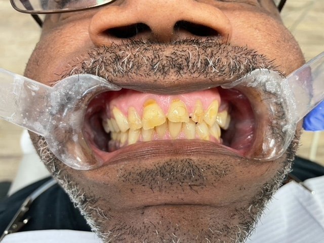 Dentist-Allen-Before