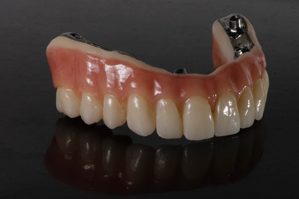 The Steps Of An All On   Dental Procedure