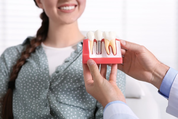 Smile Again With Dental Implants